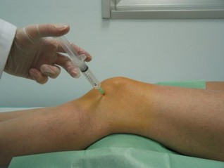 Inyecciones de acido hialuronico en rodilla